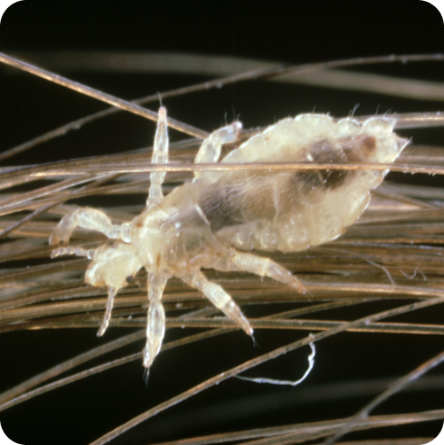 What Are Super Lice? Super Lice Symptoms & Treatment What Are Super Lice? Super Lice Symptoms & Treatment