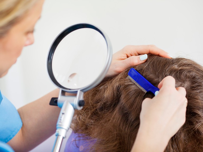 The Life Cycle of Lice: What You Need to Know