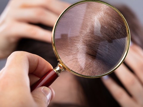 How To Tell if You’re Dealing with Superlice