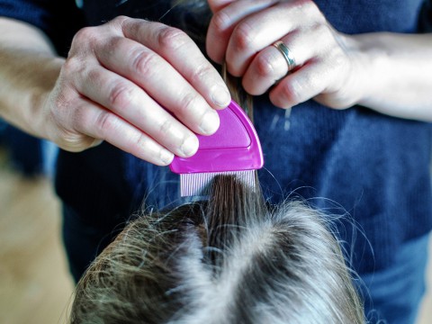 How to check for lice
